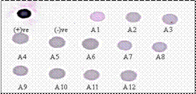 Aeromonas Detection